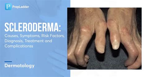 Sclerodermie symptomen