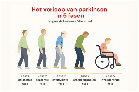 Verloop van de gordelband